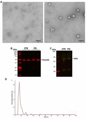 The Exosomal/Total α-Synuclein Ratio in Plasma Is Associated With Glucocerebrosidase Activity and Correlates With Measures of Disease Severity in PD Patients